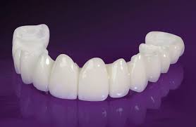 How much do dental crowns cost? How Much Does A Crown Cost