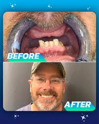 The Smile Mission Fort Lauderdale