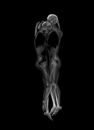 Intimate X Ray Portraits Of Cuddling Couples Xray Art Cuddling Couples X Ray