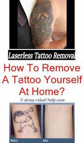 The Best Tattoo Removal Is It Safe To Get A Tattoo Removed While Breastfeeding Laser Tattoo Removal San Diego Erstes Tattoo Diy Tattoo Beeindruckende Tattoos