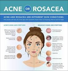 In 90% of these women the disease existed before. Acne Or Rosacea Azeco Cosmeceuticals