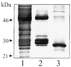 Check spelling or type a new query. Regulation Of Transducin Gtpase Activity By Human Retinal Rgs Journal Of Biological Chemistry