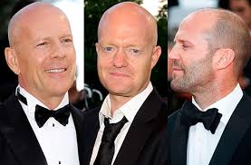 3.9 out of 5 stars. 9 Reasons Bald Men Make The Very Best Partners