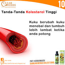 Biasanya tanda kolesterol jarang disadari. Pati Herbamadu Tanda Tanda Kolesterol Tinggi