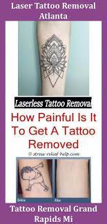 Rules regarding lasers aren't always clear, but successful tattoo removal businesses don't let confusing regulations become obstacles to their success. Tattoo Machines How To Become A Laser Tattoo Removal Technician How Well Does Wrecking Balm Tattoo Removal Work Tattoo Tatowiermaschinen Diy Tattoo Tatowieren