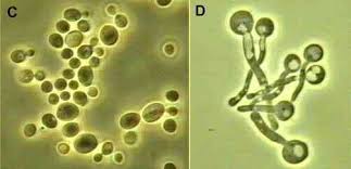 Yeasts Saccharomyces Cryptococcus Candida