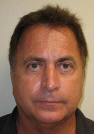 Robotic Fue Hair Transplant in Washington King Tukwila