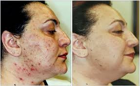 Karen — VILLANI MEDICAL