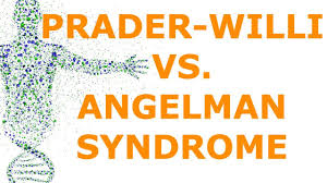 Prader Willi Vs Angelman Syndrome Imprinting