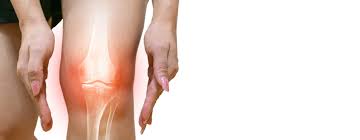 Cochrane database of systematic reviews. Knee Osteoarthritis Overview New Mexico Orthopaedic Associates P C
