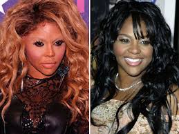 As you can see they have become more arched and elevated than before. Did Lil Kim Take Plastic Surgery Too Far Orange County Register