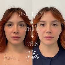 𝗧𝗥𝗨𝗘 𝗘𝗦𝗦𝗘𝗡𝗖𝗘 𝗔𝗲𝘀𝘁𝗵𝗲𝘁𝗶𝗰𝘀 (@trueessenceaesthetics) ·  Chino Hills, CA