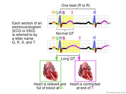 Image result for QT Interval