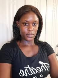 Is a government hospital in South Africa able to assist a foreign national  from Zimbabwe with an X-ray and potential broken leg, and what advice can  be given to help her get