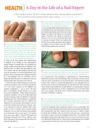 Image result for Onychotillomania feet