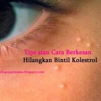 Biji kolestrol wujud di bahagian badan yang mempunyai kelenjar pilosebaceus (kawasan folikel rambut/bulu tumbuh), sama seperti jerawat. 4 Cara Hilangkan Bintik Kolestrol Di Bawah Mata Dengan Pantas