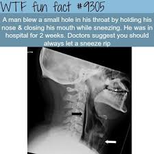Why You Shouldn T Hold Your Sneeze Wtf Fun Fact Tis Life Fact Fun Hold Life Shouldnt Sneeze Tis Wtf Wtf Fun Facts Funny Facts Fun Facts