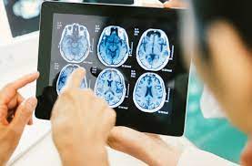 Can you vape on trains? Suspect A Concussion How To Help Not Hurt Your Recovery Health Essentials From Cleveland Clinic