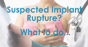 Oct 29, 2020 · signs that your silicone implant has ruptured can include changes in breast shape and size, and increasing pain, firmness, and swelling over a period of weeks. Silicone And Saline Breast Implant Rupture Symptoms Signs