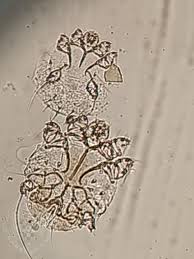 Image result for Sarcoptes scabiei life cycle