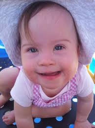 How Your Child Can Be Featured In A Babble Down Syndrome Awareness Article