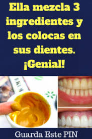 Ella Mezcla 3 Ingredientes Y Los Pone En Sus Dientes Increible Muchas Personas Sufren De Dolor De Muelas Irritacion De Las Encias Dien Remedios Dolor De Muela Remedios Caseros Naturales Y 3 Ingredientes