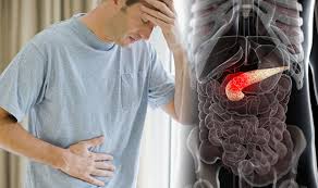 Normally, the liver releases a liquid called bile that contains bilirubin. Pancreatic Cancer Symptoms And Causes Three Early Signs Of The Disease Express Co Uk