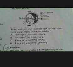 Check spelling or type a new query. Janis Cacat Mata Dan Kacamata Apakah Yang Dapat Mnolng Penderita Cacat Mata Tersebut Brainly Co Id