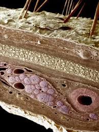 We may earn commission from links on this page, but we only r. What Is That Skin Growth Skin And Beauty Center Everyday Health