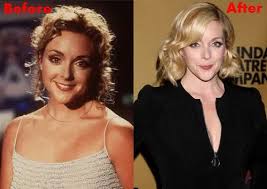 Jane Krakowski Plastic Surgery Before And After