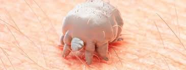 Image result for scabies transmission