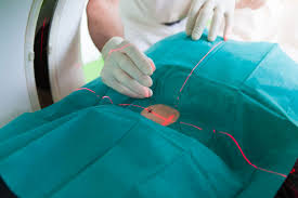 Sympathische fasern (teil des vegetativen nervensystems, unter anderem wichtig für den blutdruck); Schmerztherapie Radiologie Duisburg
