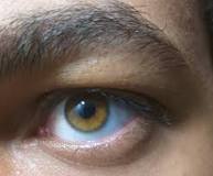 Can people have amber eyes? - iTRUST