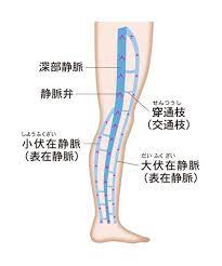 足がむくむ 血管が浮き出る 下肢静脈瘤 はなぜ起こる できやすい人や対策を医師が解説 カラダネ 静脈瘤 医師 血管