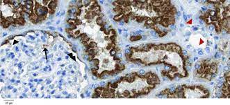 The scalable brain atlas does not own any of its templates. Lrp2 Expression In Normal Human Kidney According To Human Protein Download Scientific Diagram