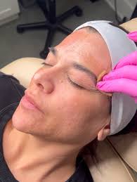 You know her. We love her. The VI Peel. 🤍 🐍 , Ready to get the peel of  your dreams? This treatment is perfect during the colder months, giving  your skin the ultimate reset. The VI Peel targets fine ...