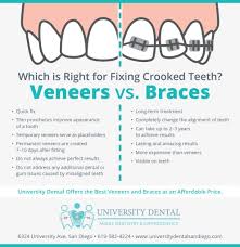 With a better bite, you'll be able to eat and chew foods better as well. Veneers Vs Braces Which Is Right For Fixing Crooked Teeth University Dental San Diego Ca