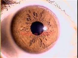 china iridology chart chinese osaka iridology china eye