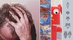 White stools or white specks in stools are not normal. Lice Vs Dandruff Nits Dry Scalp What S The Difference Guide