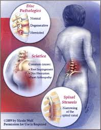 Pin On Ergonomic Posture And Exercises