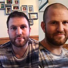 Newbold RFC 'braves the shave' to support NHS