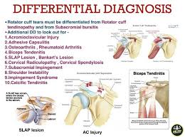 Image result for Rotator Cuff Triad Test