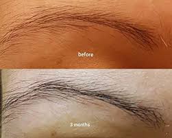 I've seen a youtube tutorial, where an influencer suggested to lightly rub the serum between both palms and spread it all around the hair while gently. The Ordinary Multi Peptide Serum For Hair Density 60ml For All Hair Types Pricepulse