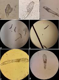 Image result for Demodex brevis
