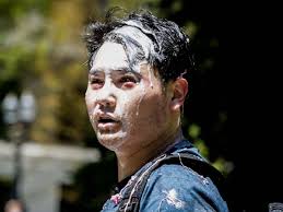 Antifa Attack Conservative Blogger Andy Ngo Amid Violence At Portland Proud Boys Protest The Independent The Independent