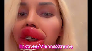 Most Extreme Swollen Bimbo Fake Botox Lips in Public | Vienna Xtreme