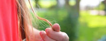 Telogen effluvium and alopecia areata. Stress Hair Loss How To Regain Hair Clinicana