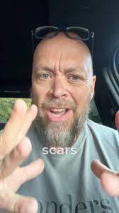 The Redemption of Our Scars! ❤️ #redeemed #scars #jesus