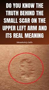 This Is The Truth Behind The Scar Everyone Has On The Upper Left Arm Know The Truth Scar Truth