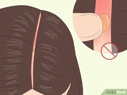 The skin will be red, painful, and hot to the touch, during this time. 9 Ways To Deal With A Scalp Sunburn Wikihow